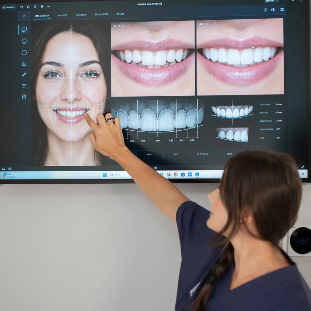 Faccette dentali a Saluzzo