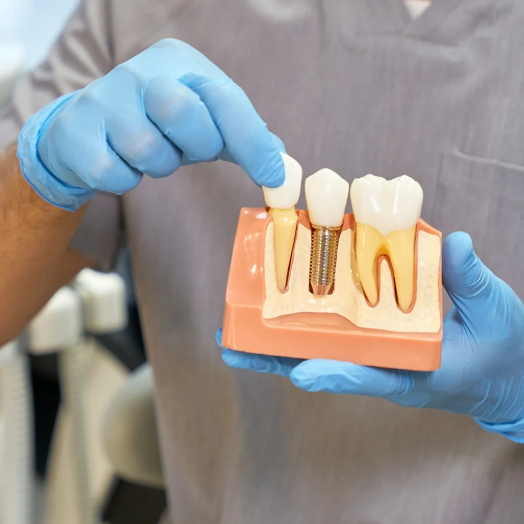 Impianto dentale a Saluzzo