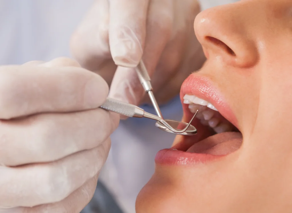 Come si diagnostica la parodontosi