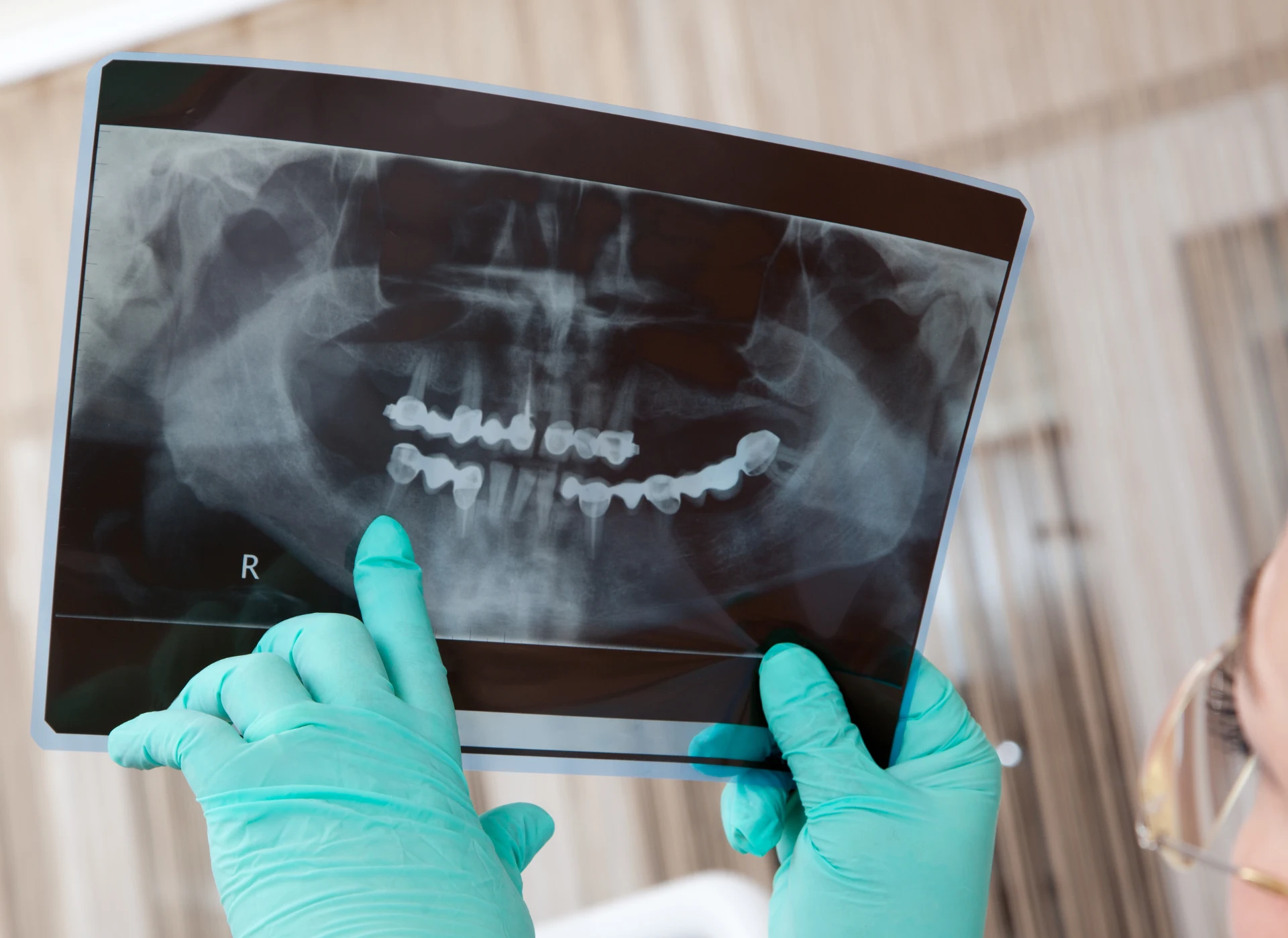 Blog - Studio dentistico a Racconigi