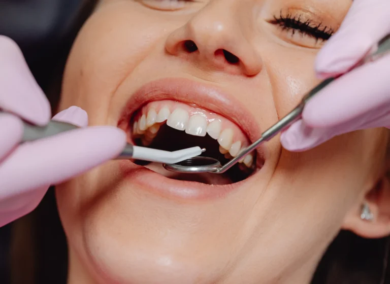 Blog 1 Ogni quanto fare la pulizia dentale