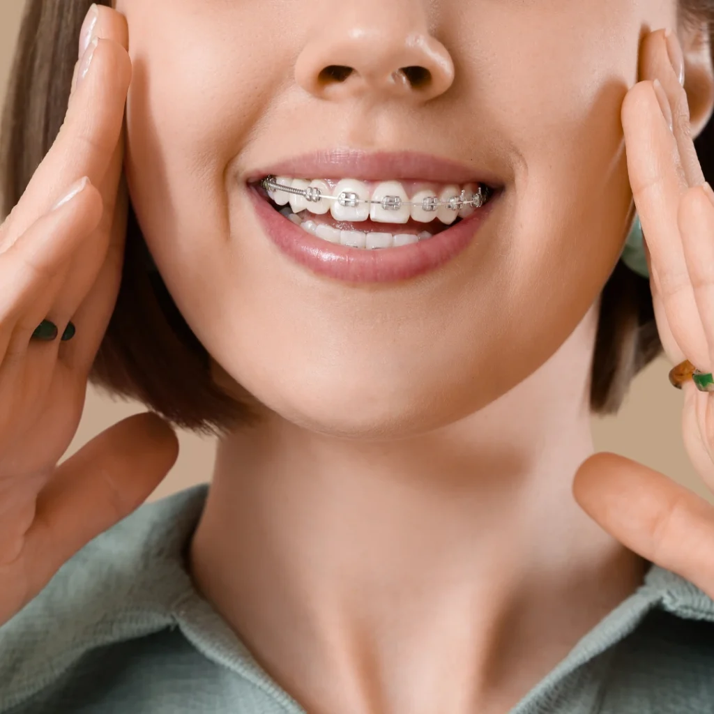 Apparecchio dentale a Saluzzo