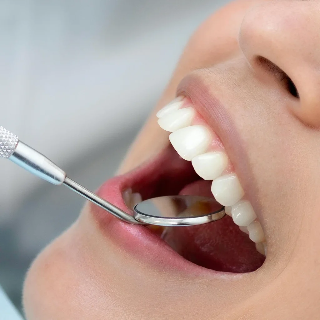 Cura della Parodontite a Saluzzo - dentista a Saluzzo